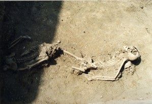 Esqueletos de dos soldado francéses excavados en el Hospital Militar Provisional francés de Tolosa.
